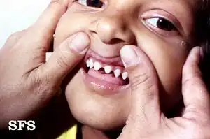 Small teeth