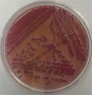 Stool culture yielded pure growth of Klebsiella oxytoca
