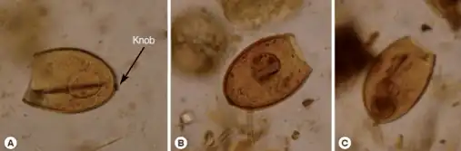 a-c)Diphyllobothrium sp. eggs