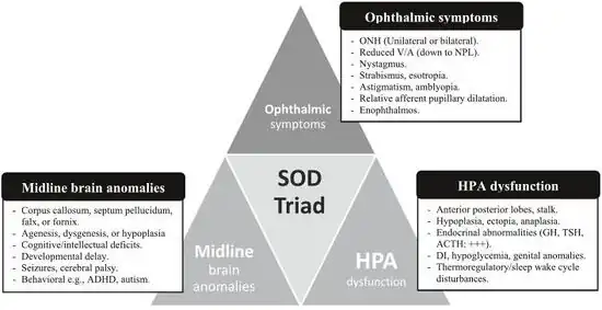 Summary of triad of SOD and its clinical manifestations[8]