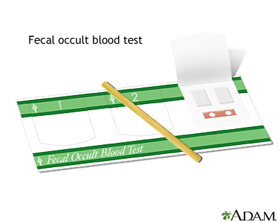 Fecal occult blood test Fecal occult blood test