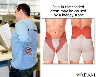 Kidney pain Kidney pain