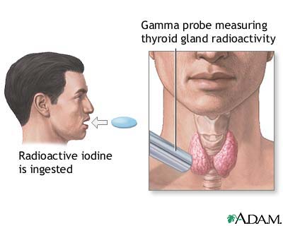 Thyroid uptake test