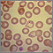 Malaria, microscopic view of cellular parasites Malaria, microscopic view of cellular parasites