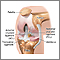 Knee arthroscopy - series - Normal anatomy