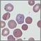 Malaria, microscopic view of cellular parasites Malaria, microscopic view of cellular parasites