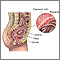 Chorionic villus sampling - normal anatomy