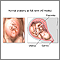 Vaginal birth - series - normal anatomy Vaginal birth - series - normal anatomy