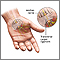 Compression of the median nerve Compression of the median nerve