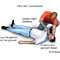 Convulsions - first aid - series Convulsions - first aid - series