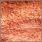 Acanthosis nigricans - close-up Acanthosis nigricans - close-up