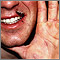Erythema multiforme on the hand Erythema multiforme on the hand