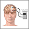 Brain wave monitor Brain wave monitor
