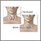 Incision for thyroid gland surgery Incision for thyroid gland surgery