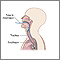 Esophageal pH monitoring Esophageal pH monitoring