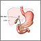 Gallbladder anatomy Gallbladder anatomy