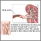 Renal arteries