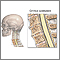 Cervical spondylosis Cervical spondylosis
