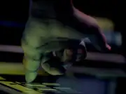 Benzite hand, Mendon