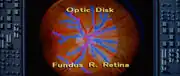 Fundus and optic disk