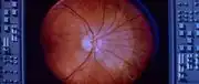 James T. Kirk's retina