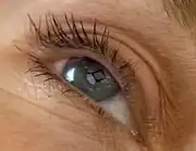 Leijten's eye