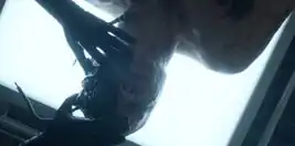 Patient 8923-3 having his Borg implants removed