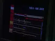Picard's vitals