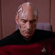 Picard with dermaplastic grafts