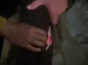 Riker's injured calf