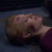 Seven with plasma burns