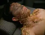 The Doctor's nanoprobes in progress