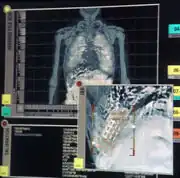 Triannon internal scan