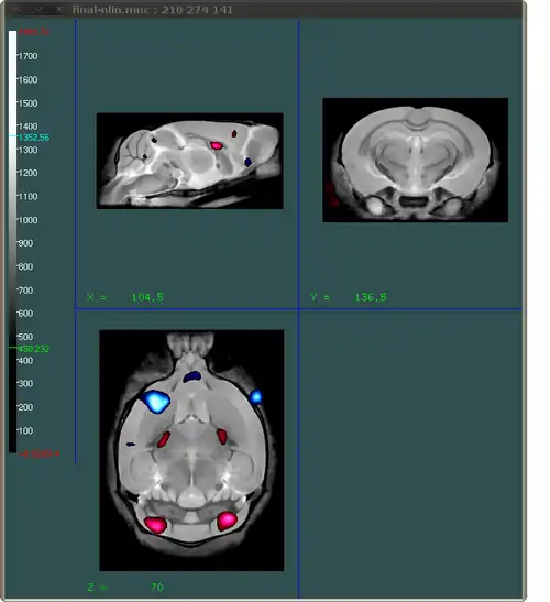 Display overlaying images final result with cursor removed and trinlinear interpolation