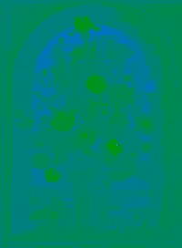 The blue-green component