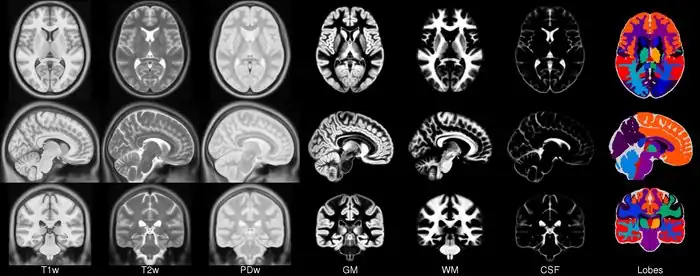MNI152 Symmetric Nonlinear template 2009c