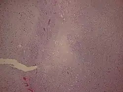 Low power microscopy