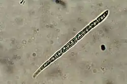 Acicular spore of B.&nbsp;schweinitzii, 65 x 6 micrometres, photographed through a compound microscope, x1000