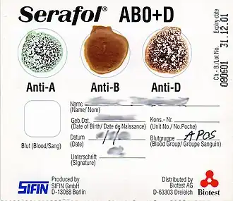A blood typing card showing agglutination of red blood cells with anti-A and anti-D and a negative result with anti-B, indicating a type A positive blood type