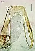Female terminal abdominal segment