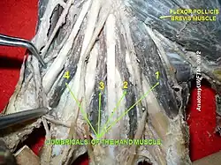 Lumbricals of the hand