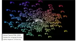 showing man sub-cortical structures