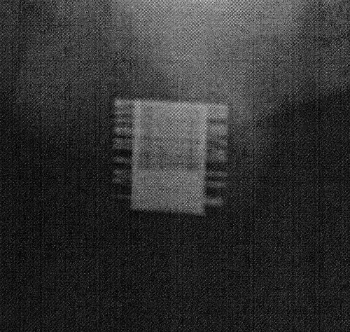 An X-ray image of implanted ZSI 375. The device is activated – the spring is decompressed at the top of the cylinder. Patient is continent.