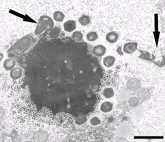 Electron micrograph of a virus factory in an amoeba co-infected with Zamilon virophage (small particles) and Mont1. Arrows show abnormal Mont1 particles (scale bar: 0.1&nbsp;μm)