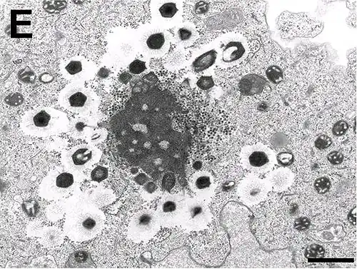 Electron micrograph of virus factory in an amoeba co-infected with Zamilon and Mont1 (scale bar: 0.1&nbsp;μm)