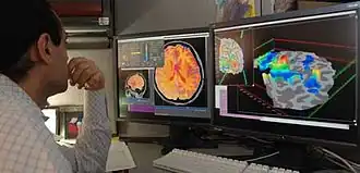 FMRI